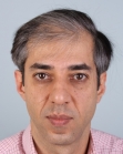 Before Hair Transplant &nbsp;2 Sessions (Areas)